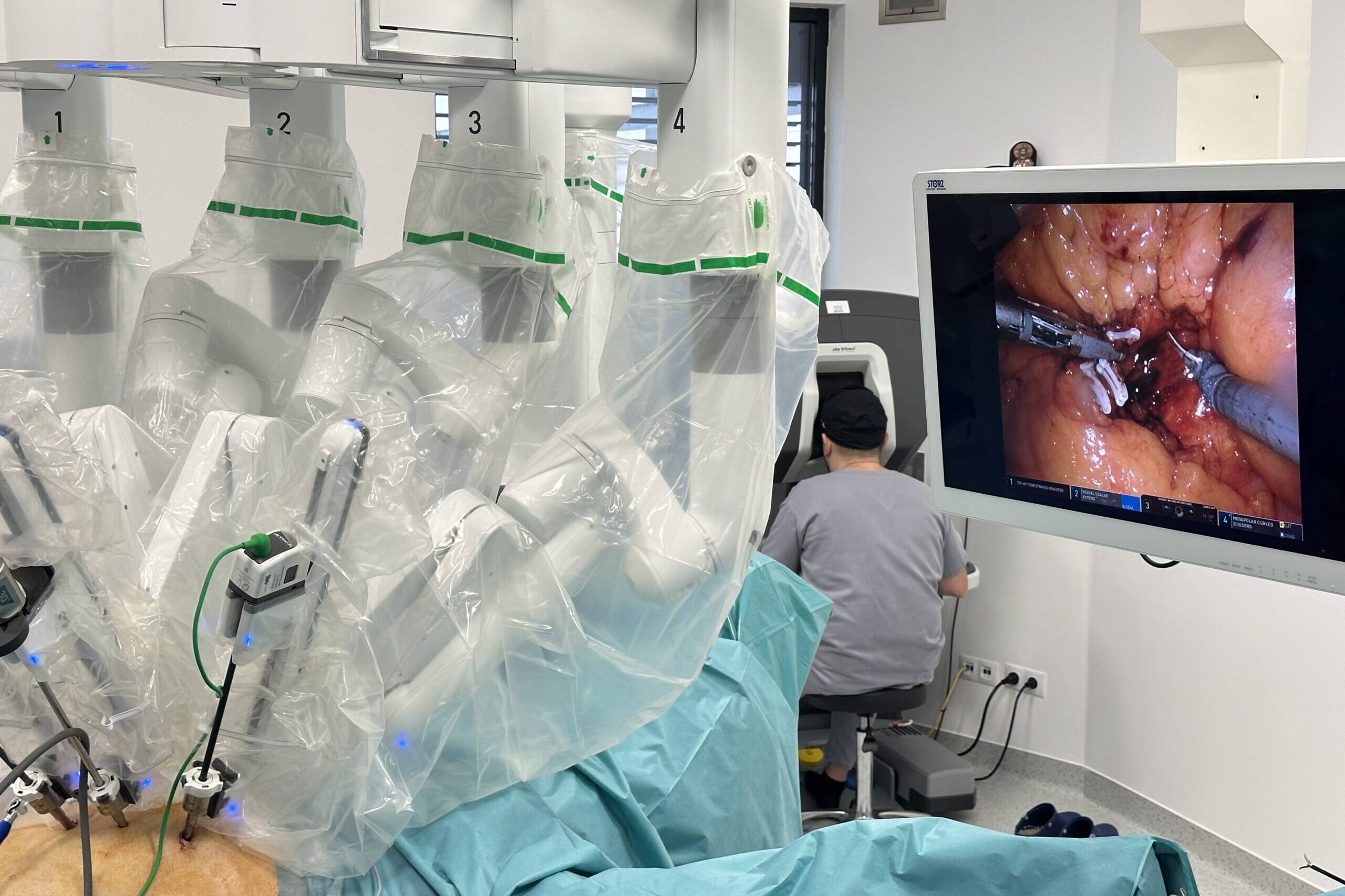 chirurgia minim invaziva a cancerului pancreatic