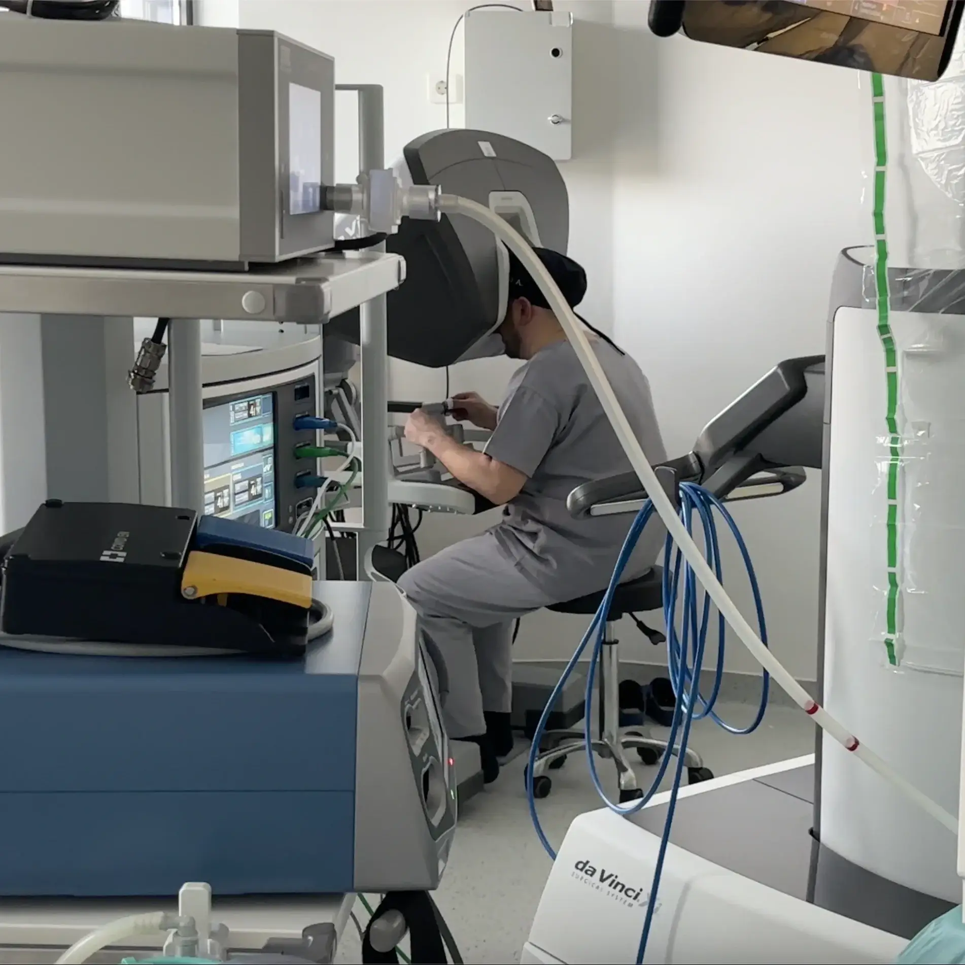 chirurgie minim invaziva robotica a cancerului pancreatic