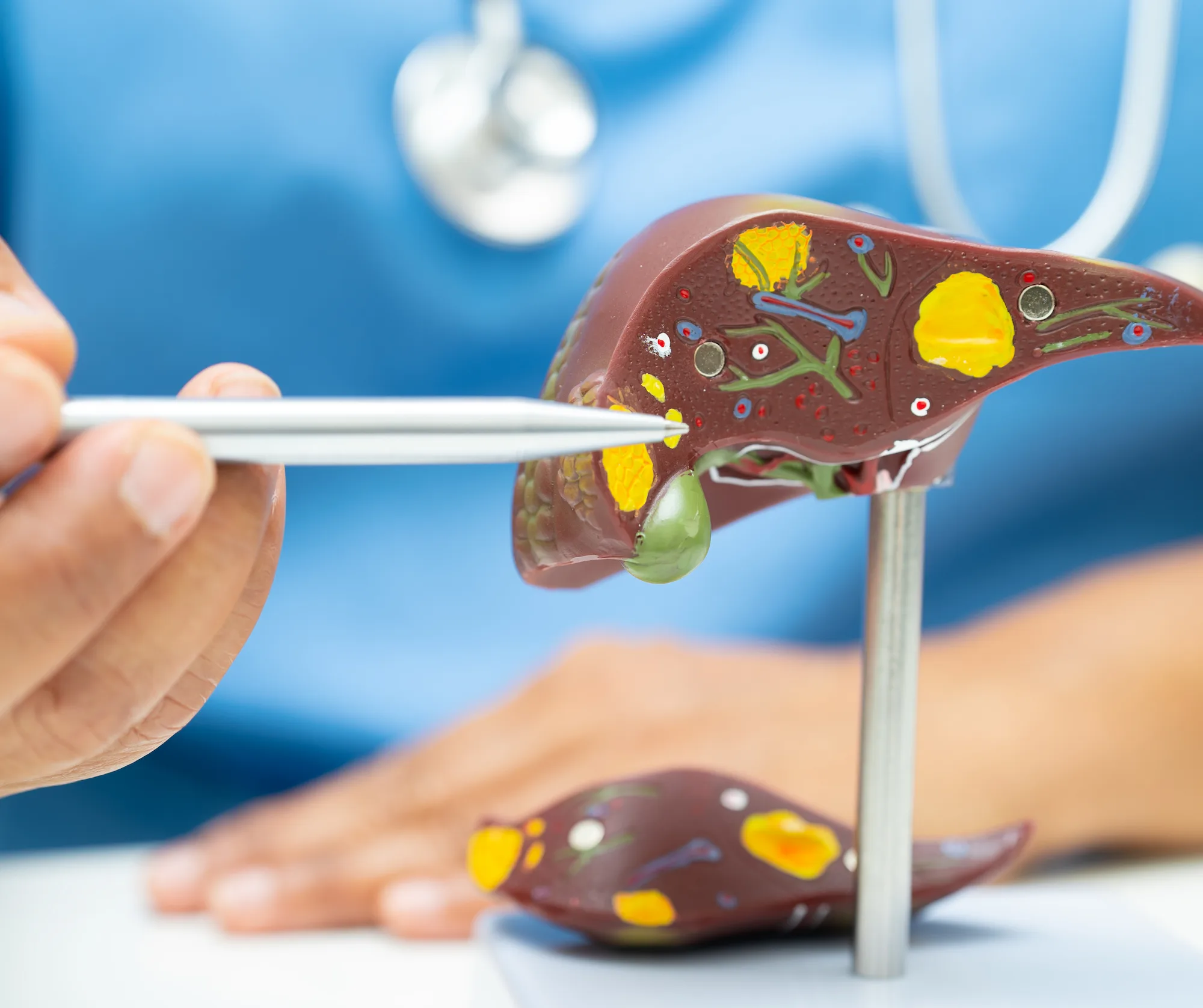 ablatia cu microunde